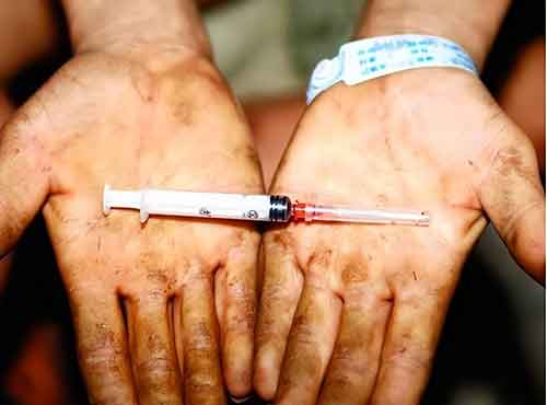 基于机器学习的HIV感染者重症监护病房入院风险预测模型构建与验证